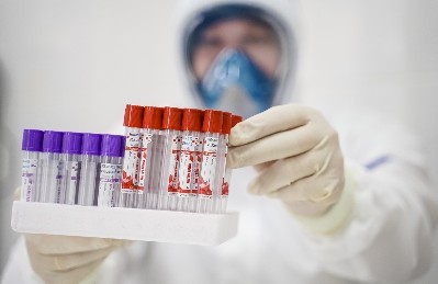 пцр анализы