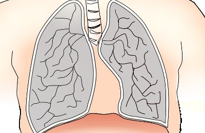Скрининг на раннее выявление рака легких будут проходить казахстанцы